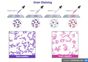 Gram Staining - Definition, Diagram, Principle and Procedure [PDF]