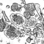 Nipah Virus (NiV) - Details