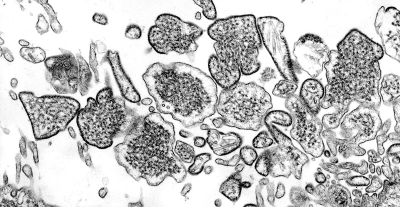 Nipah Virus (NiV) - Details
