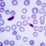 malaria treatment drugs