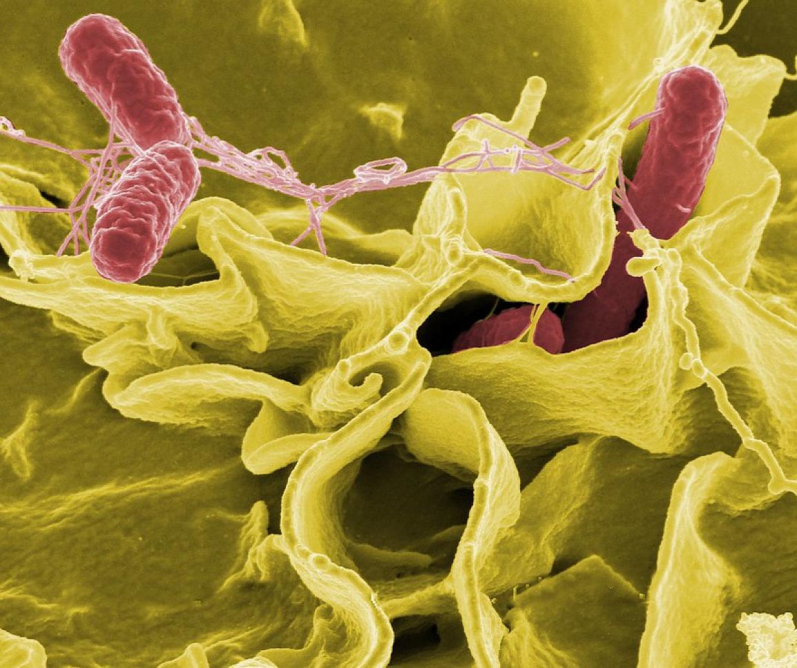Salmonella and Food Poisoning - Salmonellosis