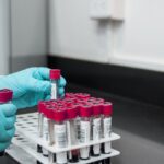 blood test