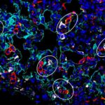 lung repair