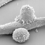 t cell lymphoma representation