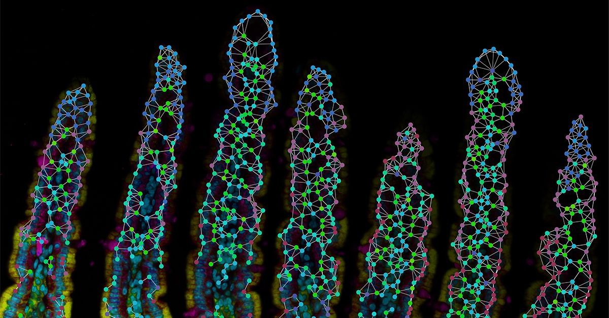 Villi SmIntestine 1200 628 1 22 25