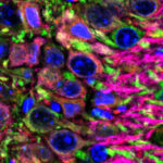 AlzhimerNeurones SauraLab webUAB