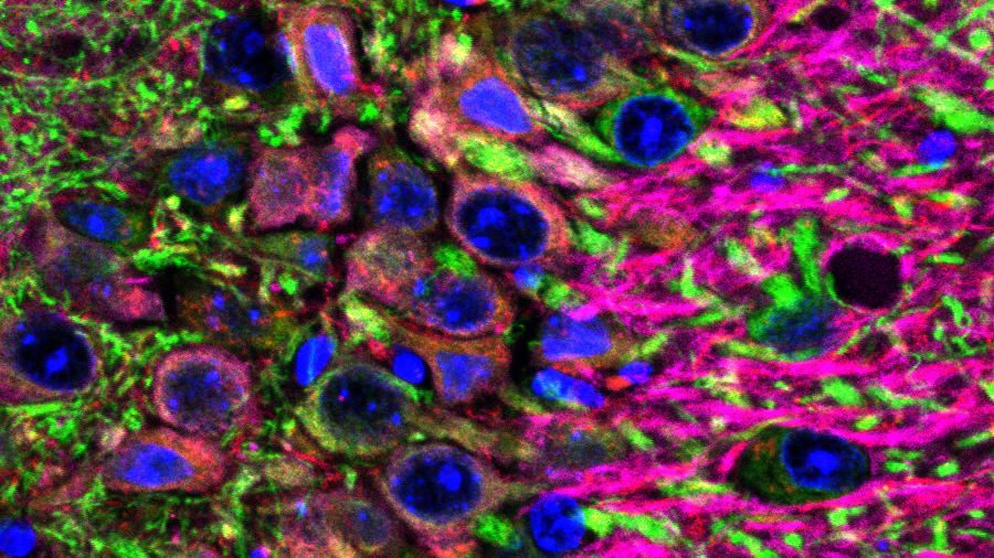 AlzhimerNeurones SauraLab webUAB