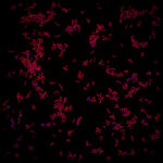TB Bacterium 705 2 5 25