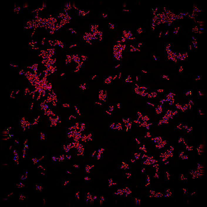 TB Bacterium 705 2 5 25