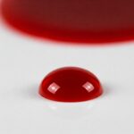 blood cloating disorder